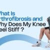 What Is Arthrofibrosis