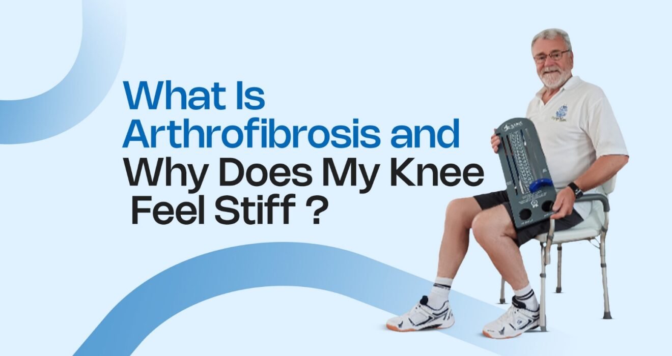 What Is Arthrofibrosis
